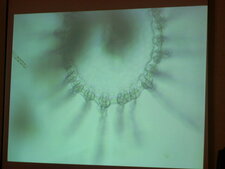 Zooplancton microscopique de méduse